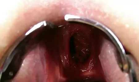 سبک سگی, مانند یک دیوانه تلگرام سکسی خارجی خروج